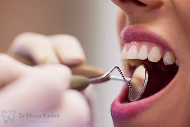 بهترین دکتر کامپوزیت دندان در مشهد کیست؟