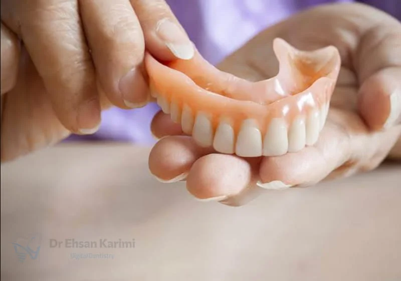 طول عمر دندان مصنوعی و پروتز دندان چقدر است؟ آیا دائمی است؟