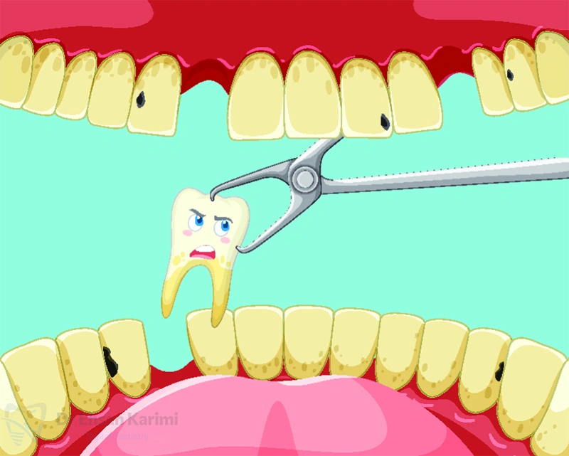 بهترین دندانپزشک برای کشیدن دندان در مشهد کیست؟