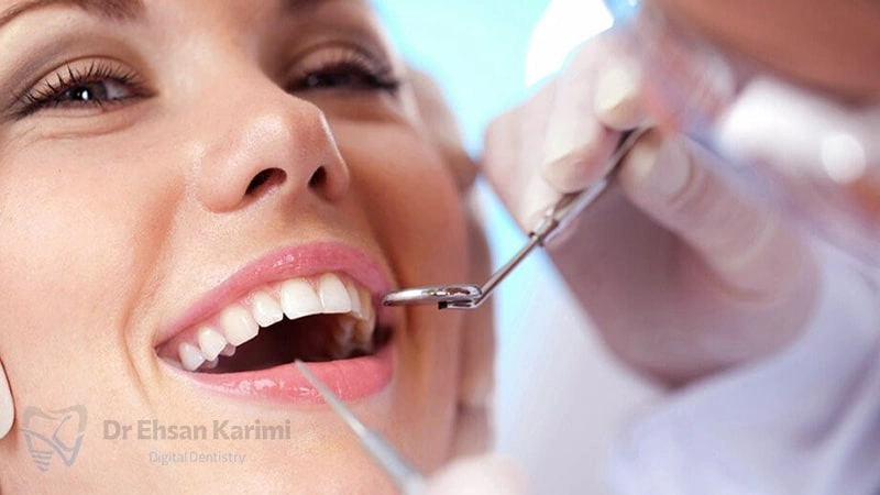 برای پر کردن دندان در مشهد چه کنیم؟
