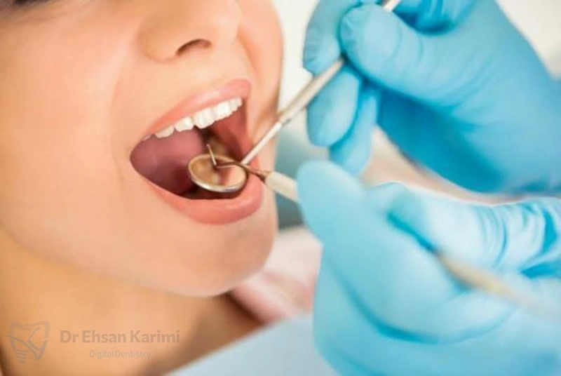 برای پر کردن دندان در مشهد چه کنیم؟