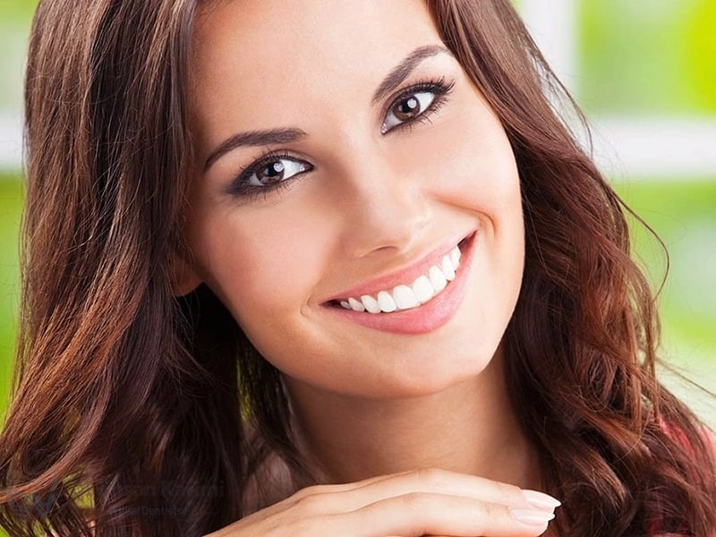 لبخند هالیوودی چیست؟