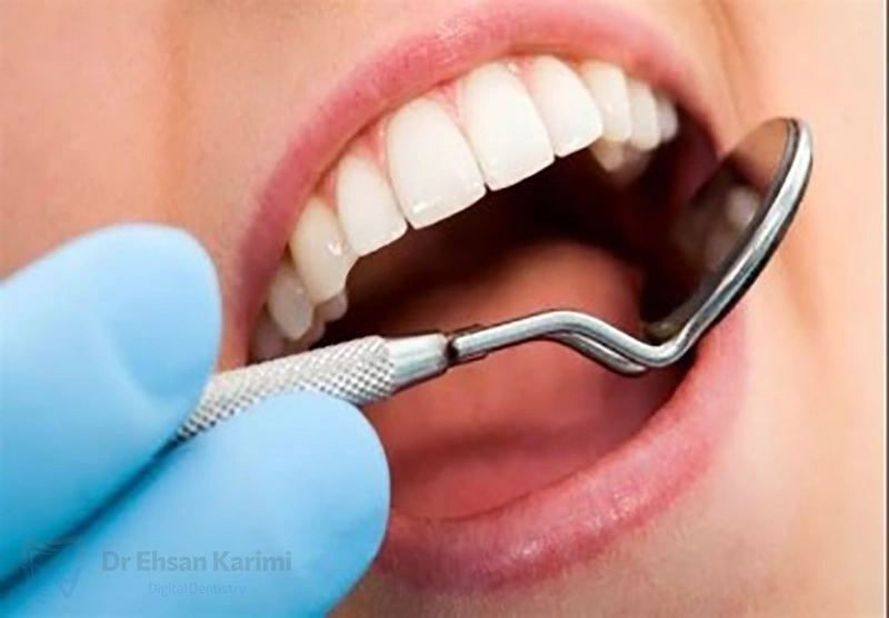 ایمپلنت دندان چند جلسه طول میکشد؟