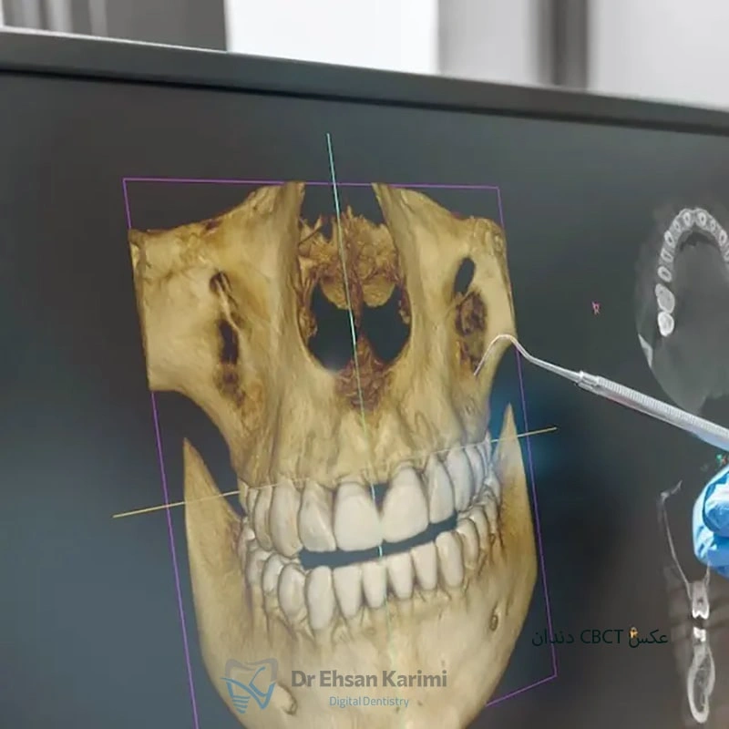 عکس CBCT دندان چیست و چه زمانی نیاز است؟