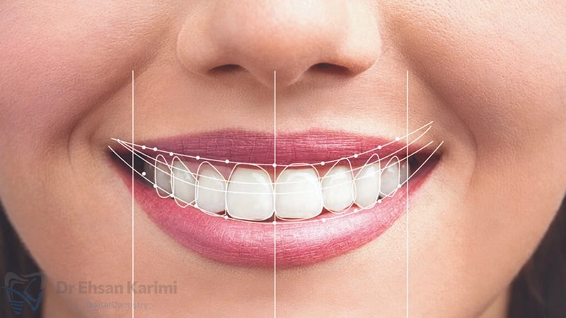 طراحی لبخند دیجیتال در مشهد