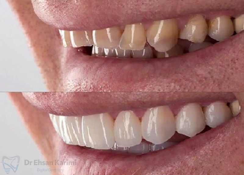 طراحی لبخند دیجیتال در مشهد